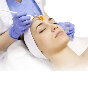 Chemical Peel
